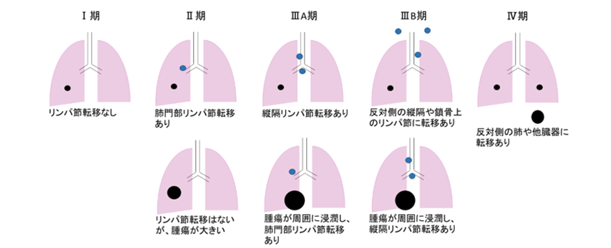 胃の不調、食欲不振、体重減少